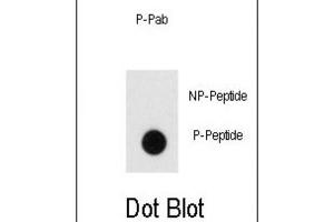 Dot Blot (DB) image for anti-Endophilin (pTyr80) antibody (ABIN3001911) (Endophilin (pTyr80) 抗体)