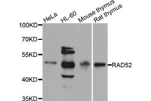 Western blot analysis of extracts of various cell lines, using RAD52 antibody (ABIN5971575) at 1/1000 dilution. (RAD52 抗体)