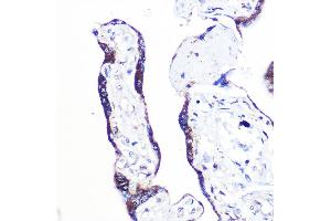 Immunohistochemistry of paraffin-embedded human placenta using PEX2 Rabbit pAb (ABIN7269248) at dilution of 1:100 (40x lens). (PEX2 抗体  (AA 1-130))