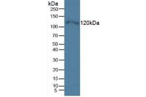 Western blot analysis of Human HeLa cells. (TLR5 抗体  (AA 693-858))