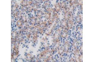 Figure. (LPHN3 抗体  (AA 1105-1447))