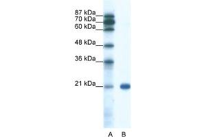 WB Suggested Anti-SSX2 Antibody Titration:  0. (SSX2 抗体  (C-Term))