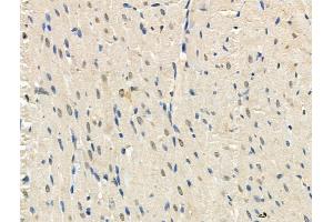 Phospho-TORC2 (Ser275) Antibody at 1/100 staining Rat heart tissue by IHC-P. (CRTC2 抗体  (pSer275))