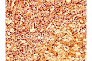 IHC image of ABIN7151937 diluted at 1:300 and staining in paraffin-embedded human adrenal gland tissue performed on a Leica BondTM system. (ESRP2 抗体  (AA 615-720))