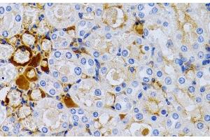Immunohistochemistry of paraffin-embedded Rat kidney using TFF1 Polyclonal Antibody at dilution of 1:200 (40x lens). (TFF1 抗体)