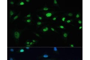 Immunofluorescence analysis of U-2 OS cells using MDC1 Polyclonal Antibody at dilution of 1:100. (MDC1 抗体)