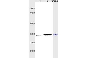 Lane 1: rat brain lysates Lane 2: rat heart lysates probed with Anti CD1A Polyclonal Antibody, Unconjugated (ABIN702700) at 1:200 in 4 °C. (CD1d1 抗体  (AA 51-150))