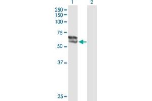 Western Blot analysis of STS expression in transfected 293T cell line by STS MaxPab polyclonal antibody. (STS 抗体  (AA 1-583))