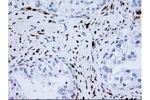 Image no. 1 for anti-NudE Nuclear Distribution E Homolog (A. Nidulans)-Like 1 (NDEL1) antibody (ABIN1499853) (NDEL1 抗体)