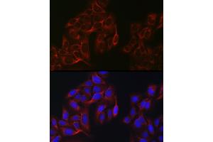 Immunofluorescence analysis of U2OS cells using eIF4 Rabbit pAb (ABIN6129659, ABIN6140076, ABIN6140077 and ABIN6220909) at dilution of 1:100 (40x lens). (EIF4A1 抗体  (AA 1-406))