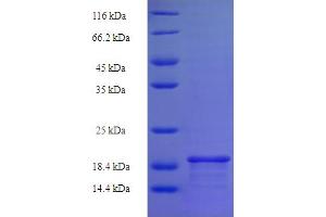 SDS-PAGE (SDS) image for Basic Leucine Zipper Transcriptional Factor ATF-Like 3 (BATF3) (AA 1-133), (full length) protein (His tag) (ABIN5709115) (BATF3 Protein (AA 1-133, full length) (His tag))