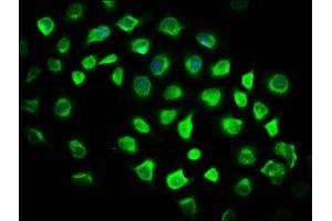 Immunofluorescence staining of A549 cells with ABIN7176582 at 1:116, counter-stained with DAPI. (GLIS2 抗体  (AA 332-505))