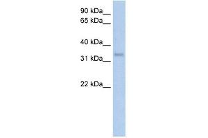WB Suggested Anti-CA4 Antibody Titration:  5. (CA4 抗体  (Middle Region))