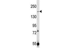 Western Blotting (WB) image for anti-Transient Receptor Potential Cation Channel, Subfamily M, Member 7 (TRPM7) (AA 1821-1850) antibody (ABIN3029239)