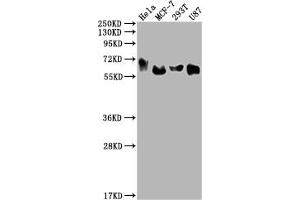 Western Blot Positive WB detected in: Hela whole cell lysate, MCF-7 whole cell lysate, 293T whole cell lysate, U87 whole cell lysate All lanes: GBA antibody at 1:2000 Secondary Goat polyclonal to rabbit IgG at 1/50000 dilution Predicted band size: 60, 58, 55, 51, 30 kDa Observed band size: 60 kDa (Recombinant GBA 抗体)