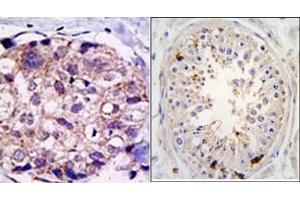 Image no. 1 for anti-Ubiquitin Specific Peptidase 2 (USP2) (C-Term) antibody (ABIN357521) (USP2 抗体  (C-Term))
