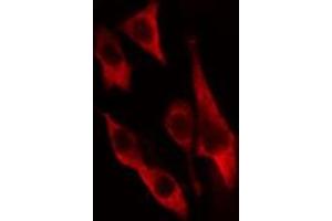 ABIN6274653 staining HeLa cells by IF/ICC. (CYP2U1 抗体  (Internal Region))