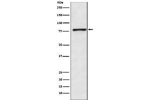 Western blot analysis of Fructose 6 Phosphate Kinase expression in HeLa cell lysate. (Recombinant PFKM 抗体)