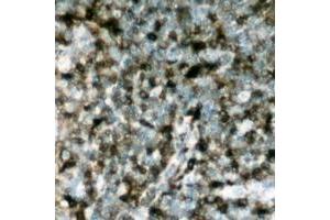 Immunohistochemical analysis of p47 phox (pS304) staining in human lymph node formalin fixed paraffin embedded tissue section.