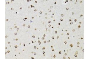 Immunohistochemistry of paraffin-embedded rat brain using TMPO Antibody (ABIN1875122) at dilution of 1:100 (40x lens). (Thymopoietin 抗体)