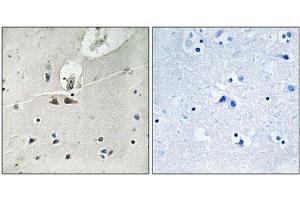 Immunohistochemical analysis of paraffin-embedded human brain tissue using Ephrin B1/B2/B3 (Phospho-Tyr324) antibody (left)or the same antibody preincubated with blocking peptide (right). (Ephrin B1 抗体  (pTyr324))