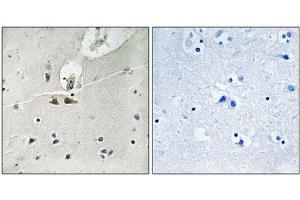 Immunohistochemical analysis of paraffin-embedded human brain tissue using Ephrin B1/B2/B3 (Phospho-Tyr324) antibody (left)or the same antibody preincubated with blocking peptide (right). (EFNB1/EFNB2/EFNB3 (pTyr324) 抗体)