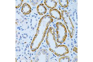 Immunohistochemistry (IHC) image for anti-Microtubule-Associated Protein 2 (MAP2) (AA 260-559) antibody (ABIN3016265)