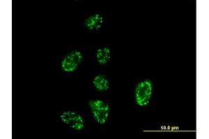 Immunofluorescence of purified MaxPab antibody to SH2D3A on HeLa cell. (SH2D3A 抗体  (AA 1-576))
