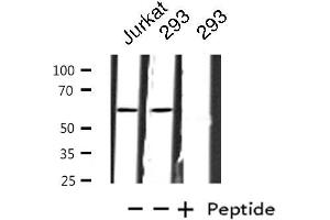 Western blot analysis of extracts from Jurkat/293 cells, using ZNF695 antibody. (ZNF695 抗体  (C-Term))