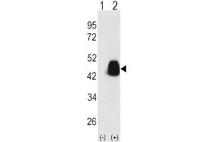 Western Blotting (WB) image for anti-Pancreatic and Duodenal Homeobox 1 (PDX1) antibody (ABIN3001419) (PDX1 抗体)