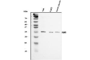 Western blot analysis of SNAP23 using anti-SNAP23 antibody (ABIN7603236).