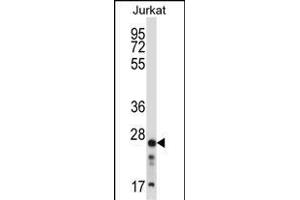 ARHGDIB Antibody (C-term) (ABIN657665 and ABIN2846658) western blot analysis in Jurkat cell line lysates (35 μg/lane). (ARHGDIB 抗体  (C-Term))