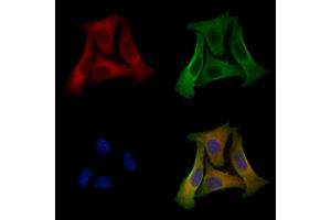 ABIN6256878 and ABIN6274572 staining Hela cells by IF/ICC. (Serotonin Receptor 2B 抗体  (Internal Region))