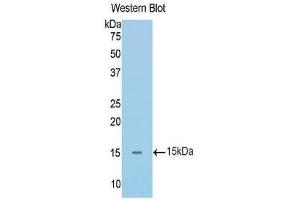 Western Blotting (WB) image for anti-Interleukin 1 Receptor, Type I (IL1R1) (AA 119-217) antibody (ABIN1172134)