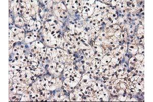 Image no. 1 for anti-Destrin (Actin Depolymerizing Factor) (DSTN) antibody (ABIN1497907) (Destrin 抗体)