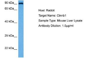 Host:  Rabbit  Target Name:  CTNNB1  Sample Tissue:  Mouse Liver  Antibody Dilution:  1ug/ml (CTNNB1 抗体  (C-Term))