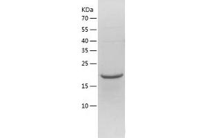 Western Blotting (WB) image for Chromosome 17 Open Reading Frame 49 (C17orf49) (AA 1-172) protein (His tag) (ABIN7122382)