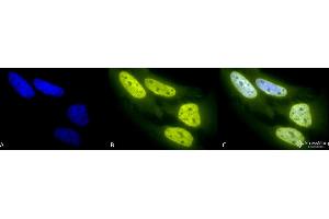 Immunocytochemistry/Immunofluorescence analysis using Rabbit Anti-Acetylated Lysine Polyclonal Antibody . (Lysine (lys) (acetylated) 抗体 (HRP))