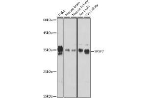 Western blot analysis of extracts of various cell lines, using SRSF7 Rabbit pAb (ABIN7270548) at 1:1000 dilution. (SFRS7 抗体  (AA 60-120))