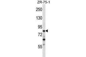 CNOT3 Antibody (N-term) western blot analysis in ZR-75-1 cell line lysates (35µg/lane).