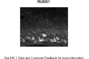 Sample Type : Mouse, post-natal day (p) 0 retinal ganglion cells Primary Antibody Dilution : 1:1500 Secondary Antibody : Donkey anti rabbit IgG Alexa 594 Secondary Antibody Dilution : 1:1000 Gene Name : RUNX1  Submitted by : Anonymous