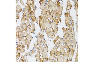 Immunohistochemistry of paraffin-embedded mouse heart using CASP3 antibody (ABIN4903140) at dilution of 1:100 (40x lens). (Caspase 3 抗体)