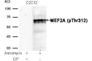 Western blot analysis of extracts from C2C12 cells, treated with Anisomycin or calf intestinal phosphatase (CIP), using MEF2A (Phospho-Thr312) Antibody. (MEF2A 抗体  (pThr312))