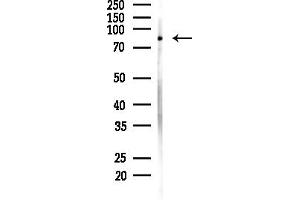 Western blot analysis of lysates from MDA-MB-231 cells(heat-shock,45 min treatment), using ML1 Antibody at 1/1000 dilution.