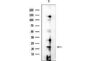 Western blot analysis of lysates from EC304 cells, using PBOV1 Antibody at 1/1000 dilution.