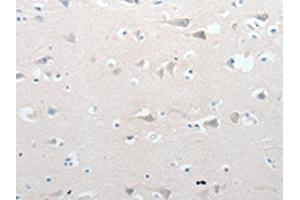 The image on the left is immunohistochemistry of paraffin-embedded Human brain tissue using ABIN7190766(GCH1 Antibody) at dilution 1/15, on the right is treated with synthetic peptide. (GCH1 抗体)