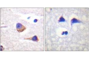 Immunohistochemistry analysis of paraffin-embedded human brain, using JAK3 (Phospho-Tyr785) Antibody. (JAK3 抗体  (pTyr785))