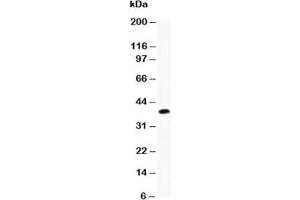Western blot testing of Caveolin-1 antibody and recombinant human protein (0. (Caveolin-1 抗体  (AA 4-178))