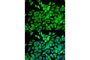 Immunofluorescence analysis of MCF-7 cells using EIF4A1 antibody. (EIF4A1 抗体)