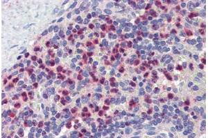 Spleen, Human: Formalin-Fixed, Paraffin-Embedded (FFPE) (GABARAPL1 抗体  (N-Term))